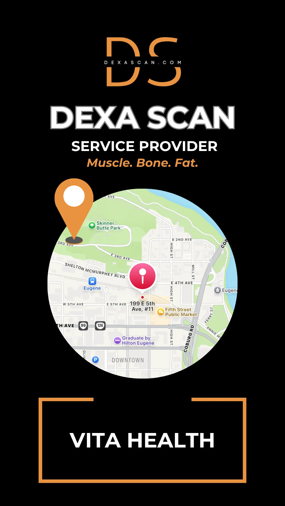 DEXA Scan in Eugene, OR 1 DEXA Scan in Eugene, OR